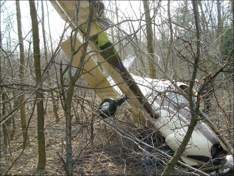 My baby after the accident