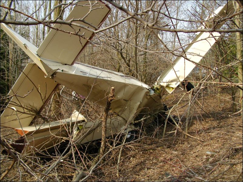 My baby after the accident